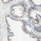 Immunohistochemical staining of human prostate shows strong granular cytoplasmic positivity in glandular cells.