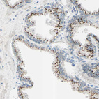 Anti-B4GALT1 Antibody