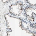 Immunohistochemical staining of human prostate shows strong granular cytoplasmic positivity in glandular cells.