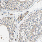 Anti-B4GALT1 Antibody