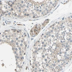 Immunohistochemical staining of human testis shows moderate granular cytoplasmic positivity in Leydig cells.