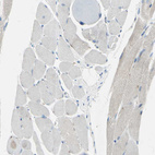 Anti-B4GALT1 Antibody