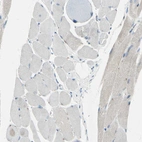 Immunohistochemical staining of human skeletal muscle shows no positivity in myocytes as expected.