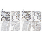 Anti-B4GALT1 Antibody