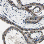 Anti-B4GALT1 Antibody