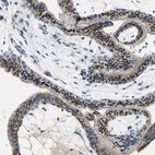 Immunohistochemical staining of human placenta shows strong granular cytoplasmic positivity in trophoblastic cells.