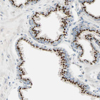 Anti-B4GALT1 Antibody