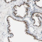 Immunohistochemical staining of human prostate shows strong granular cytoplasmic positivity in glandular cells.