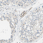 Anti-B4GALT1 Antibody