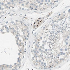 Immunohistochemical staining of human testis shows strong granular cytoplasmic positivity in Leydig cells.