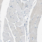 Anti-B4GALT1 Antibody