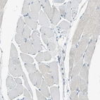Immunohistochemical staining of human skeletal muscle shows no positivity in myocytes as expected.