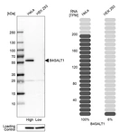 Western blot analysis in human cell lines HeLa and HEK293 using Anti-B4GALT1 antibody. Corresponding B4GALT1 RNA-seq data are presented for the same cell lines. Loading control: Anti-HSP90B1.