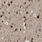 Immunohistochemical staining of human cerebral cortex shows strong nuclear/nuclear membranous-cytoplasmic positivity in neurons.