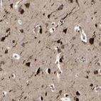 Immunohistochemical staining of human cerebral cortex shows strong nuclear/nuclear membranous-cytoplasmic positivity in neurons.