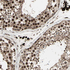 Immunohistochemical staining of human testis shows strong nuclear/nuclear membranous-cytoplasmic positivity in cells in seminiferous ducts and leydig cells.