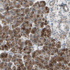 Immunohistochemical staining of human pancreas shows moderate nuclear/nucleoli/nucleoli/cytoplasmic positivity in exocrine glandular cells and endocrine glandular cells.