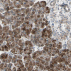Anti-MLF2 Antibody