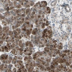 Immunohistochemical staining of human pancreas shows moderate nuclear/nucleoli/nucleoli/cytoplasmic positivity in exocrine glandular cells and endocrine glandular cells.