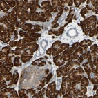 Anti-DNAJB11 Antibody