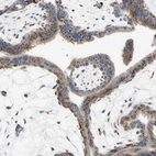 Anti-GLG1 Antibody