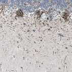 Immunohistochemical staining of human cerebellum shows strong granular cytoplasmic positivity in Purkinje cells.