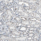 Immunohistochemical staining of human kidney shows strong granular cytoplasmic positivity in cells in tubules.