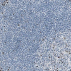 Immunohistochemical staining of human tonsil shows moderate granular cytoplasmic positivity in germinal center and non-germinal center cells.