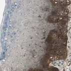 Immunohistochemical staining of human skin shows strong membranous and cytoplasmic positivity in basal cells.