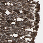 Immunohistochemical staining of human rectum shows strong membranous and cytoplasmic positivity in glandular cells.