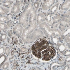 Immunohistochemical staining of human kidney shows strong membranous and cytoplasmic positivity in cells in glomeruli.