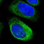 Immunofluorescent staining of human cell line A-431 shows localization to endoplasmic reticulum.