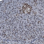Immunohistochemical staining of human pancreas shows strong nuclear positivity in islets of Langerhans and exocrine glandular cells.