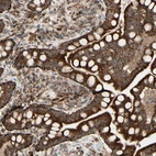 Anti-DHRS3 Antibody