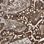 Anti-DHRS3 Antibody