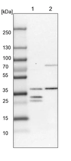 Lane 1: Mouse liver tissue lysate_br/_Lane 2: Rat liver tissue lysate