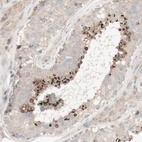 Anti-SPATA9 Antibody