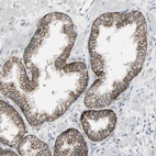 Immunohistochemical staining of human prostate shows high expression.