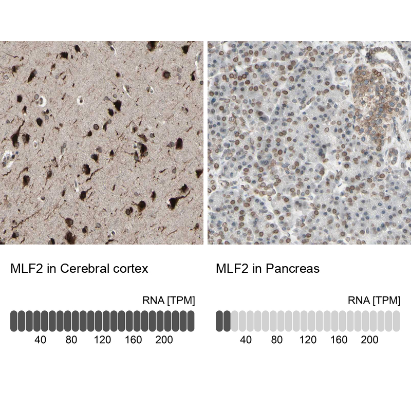Anti-MLF2 Antibody