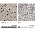 Anti-MLF2 Antibody