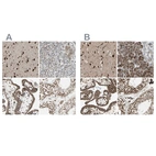 Immunohistochemical staining of human cerebral cortex, pancreas, placenta and testis using Anti-MLF2 antibody HPA010859 (A) shows similar protein distribution across tissues to independent antibody HPA010811 (B).