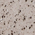 Immunohistochemical staining of human cerebral cortex shows strong nuclear/nuclear membranous-cytoplasmic positivity in neurons.