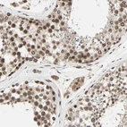 Immunohistochemical staining of human testis shows moderate nuclear-nuclear membranous-cytoplasmic positivity in cells in seminiferous ducts and leydig cells.