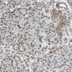 Immunohistochemical staining of human pancreas shows moderate nuclear/nuclear membranous/nuclear-cytoplasmic positivity in exocrine glandular cells and endocrine glandular cells.