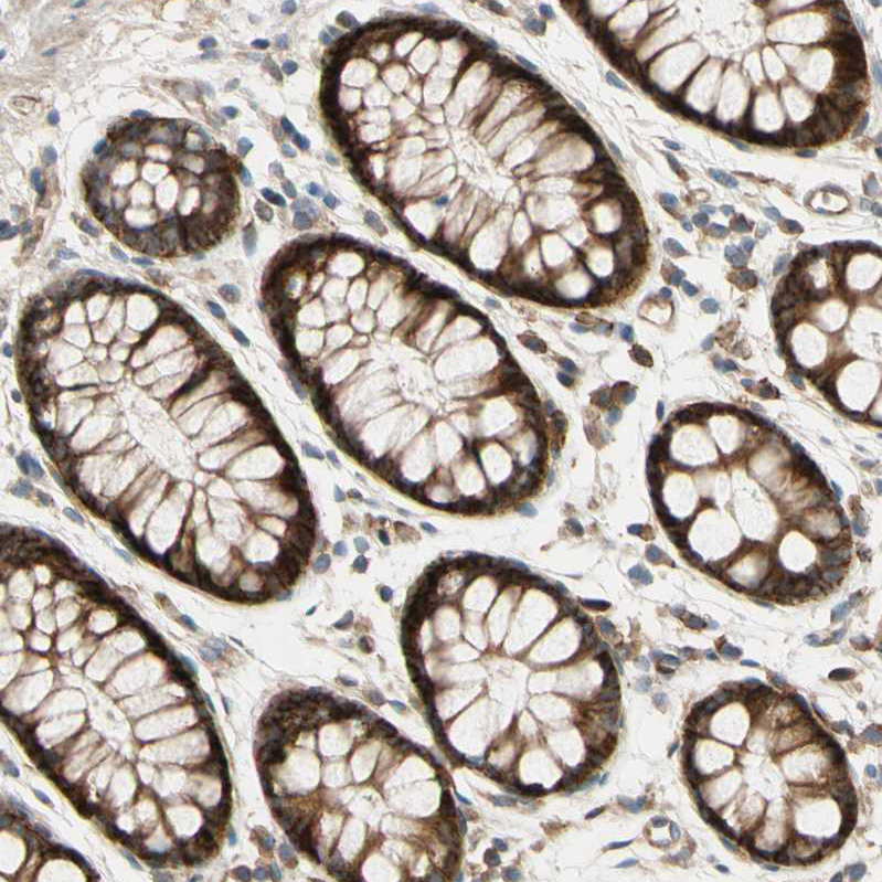 Anti-SPTLC1 Antibody