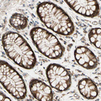 Anti-SPTLC1 Antibody
