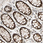 Anti-SPTLC1 Antibody