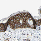Immunohistochemical staining of human skin shows strong membranous positivity in squamous epithelial cells.