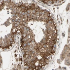 Immunohistochemical staining of human testis shows strong cytoplasmic positivity in cells in seminiferous ducts.