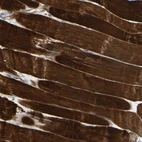 Immunohistochemical staining of human skeletal muscle shows strong cytoplasmic positivity in myocytes.